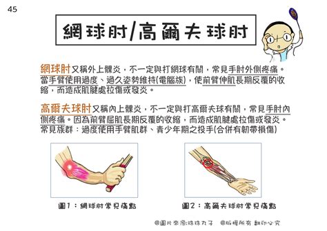 中指受傷|手肘痛、手腕痛、手指痛的原因,治療與自我檢查 » 台。